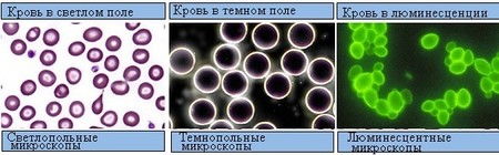 Кровь под микроскопом