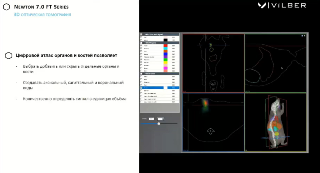 3D оптическая томография