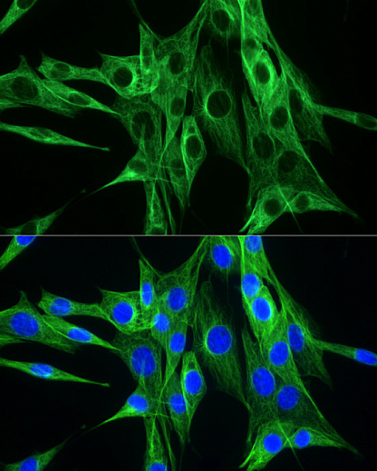 Антитела Anti-Rabbit IgG (H+L) козьи, поликлональные, коньюгированые с ABflo 488, иммунофлуоресцентный анализ  PC-12 клеток