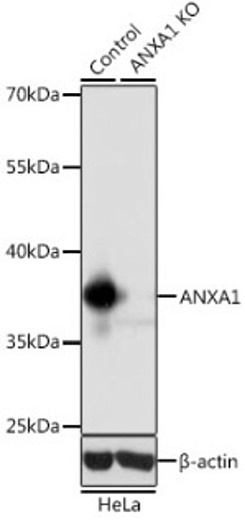 Антитела [KO Validated] ANXA1 кроличьи, поликлональные
