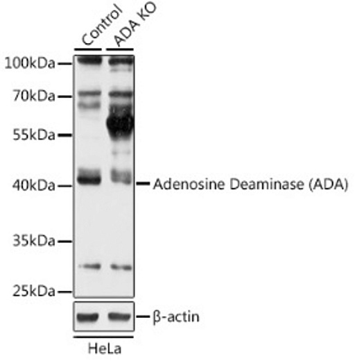 Антитела [KO Validated] Adenosine Deaminase (ADA) кроличьи, поликлональные