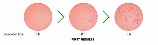 Станция автоматического инкубирования, размер колоний от 0,05 мм, со встроенным инкубатором, в режиме реального времени, ScanStation 100 Фото 2