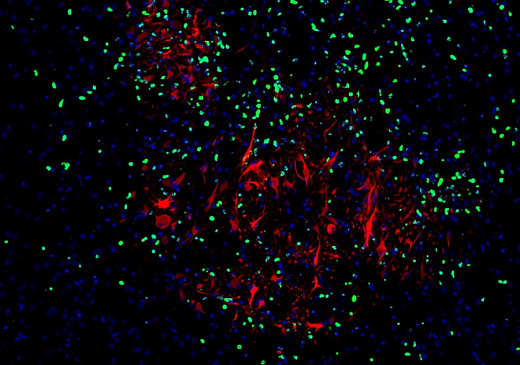 Флуоресцентный набор для двойного окрашивания (IF488+ Red IF555) TSAPLus, Servicebio, Китай